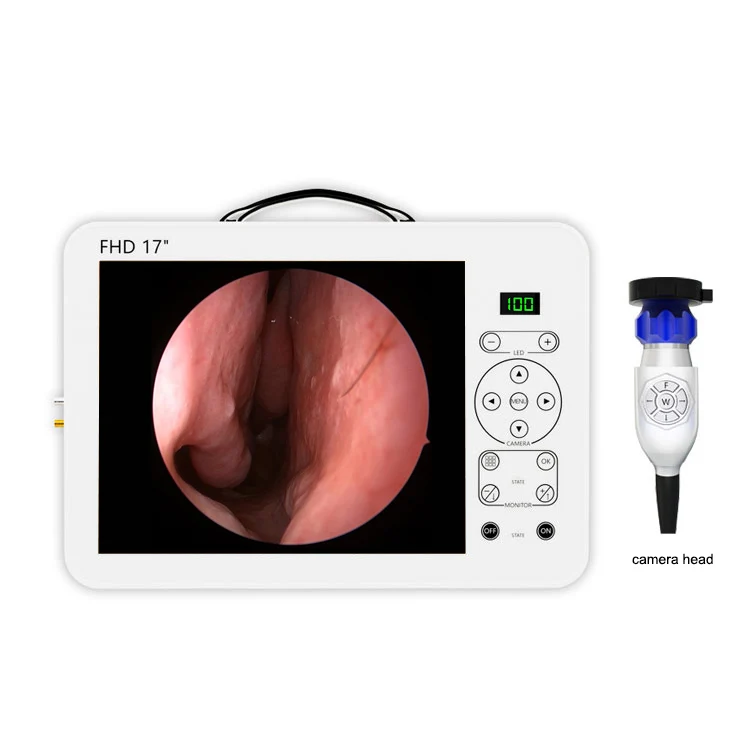 17-дюймовый HD видеоотоскоп, н – обзор и цена Medical Lab Images