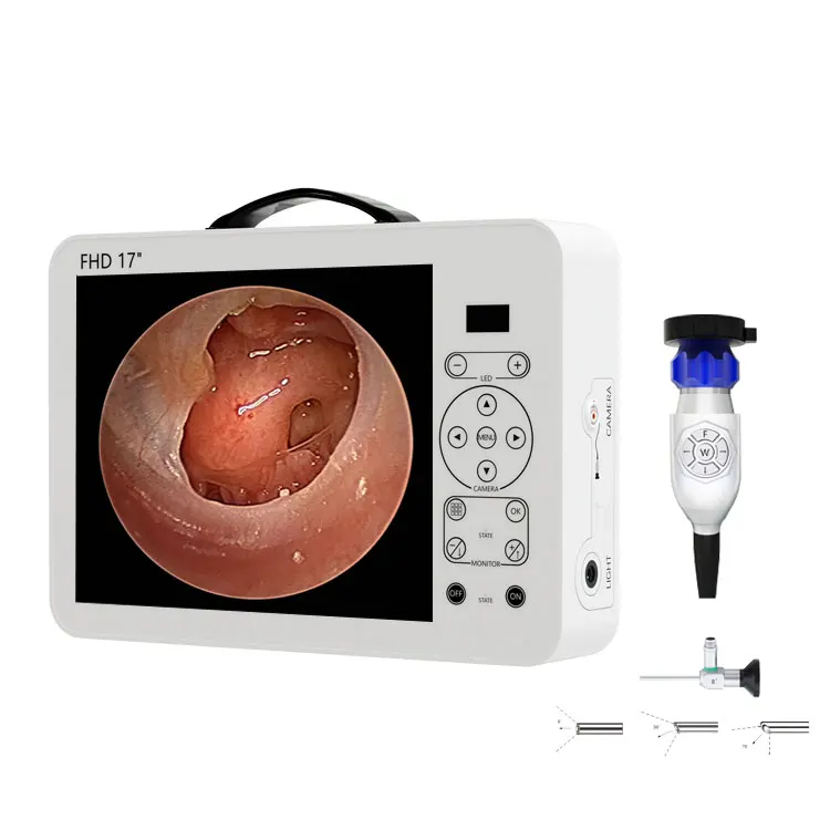 17-дюймовый HD видеоотоскоп, н – обзор и цена Medical Lab Images