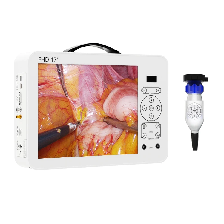 17-дюймовый HD видеоотоскоп, н – обзор и цена Medical Lab Images